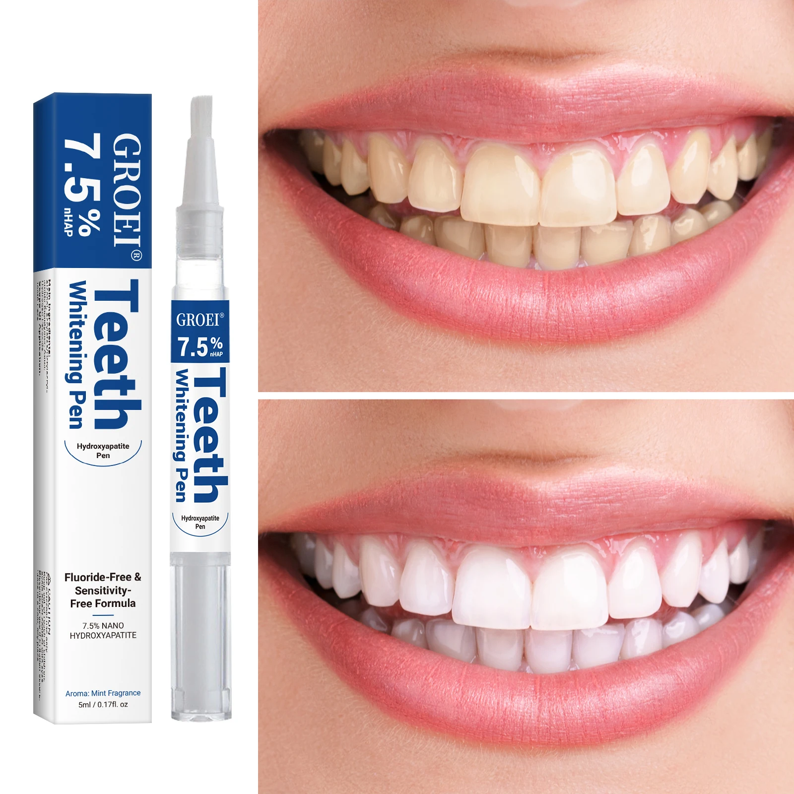 Hidroksiapatit Diş Beyazlatma  - Teeth Whitening Pens incelemesi ve fiyatı