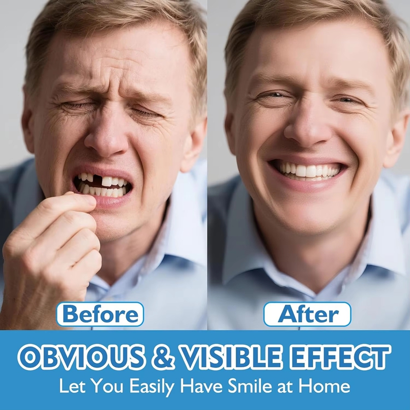Tam Set Silikon Protez Üst ve  - Teeth Whitening Moulds incelemesi ve fiyatı