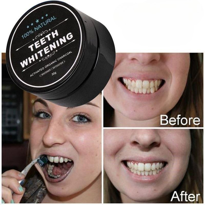 1 Kutu Aktif Kömür Diş Beyazla - Teeth Whitening Near Me incelemesi ve fiyatı