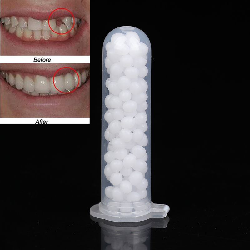 【K】1 Kutu Geçici Diş Onarım Se - Teeth Whitening Kit incelemesi ve fiyatı