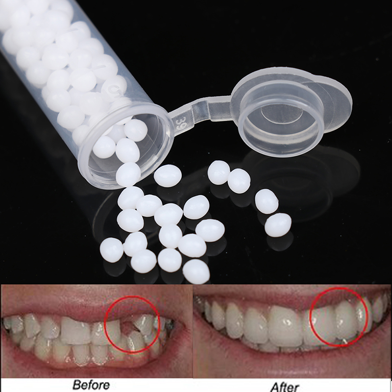 【K】1 Kutu Geçici Diş Onarım Se - Teeth Whitening Kit incelemesi ve fiyatı
