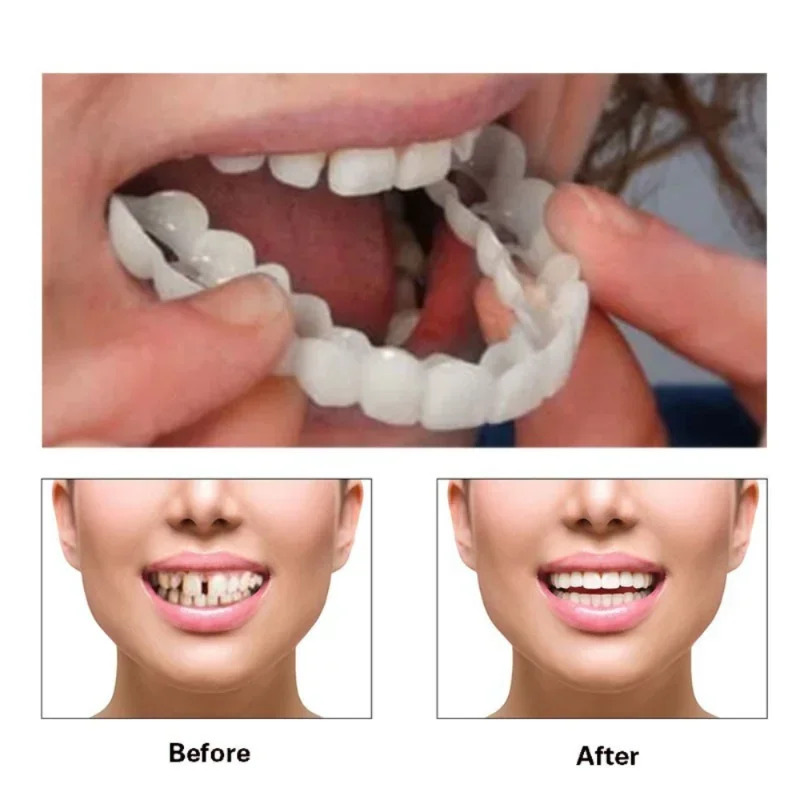 Mükemmel Uyumlu Diş Beyazlatıc - Teeth Whitening Moulds incelemesi ve fiyatı