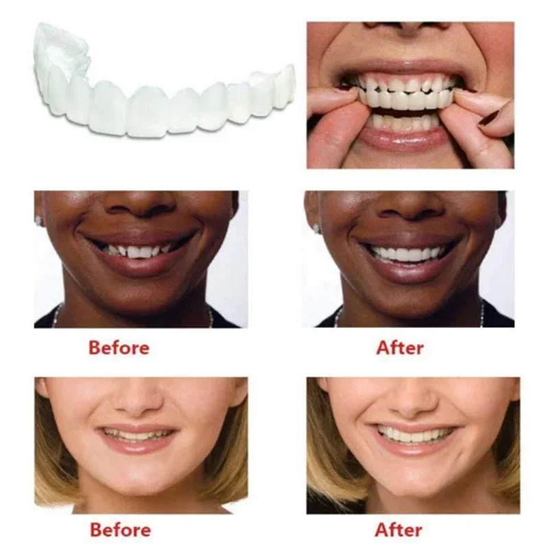 Mükemmel Uyumlu Diş Beyazlatıc - Teeth Whitening Moulds incelemesi ve fiyatı