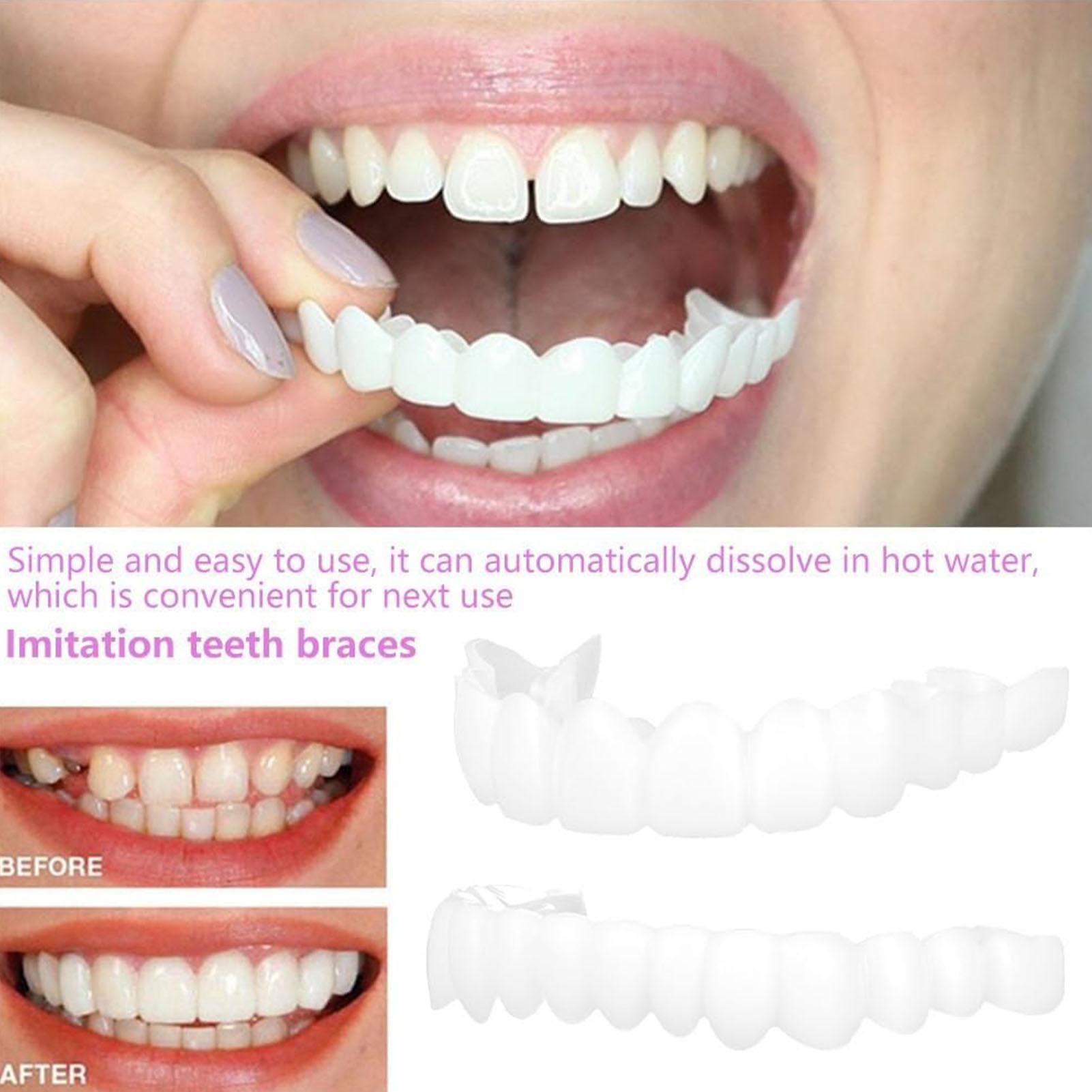 1 Çift Takma Diş Kaplaması Par - Teeth Whitening Moulds incelemesi ve fiyatı