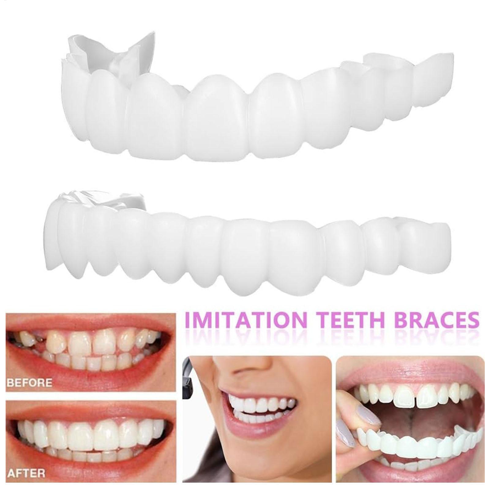 2 adet Erkek Kadın Geçici Diş  - Teeth Whitening Moulds incelemesi ve fiyatı