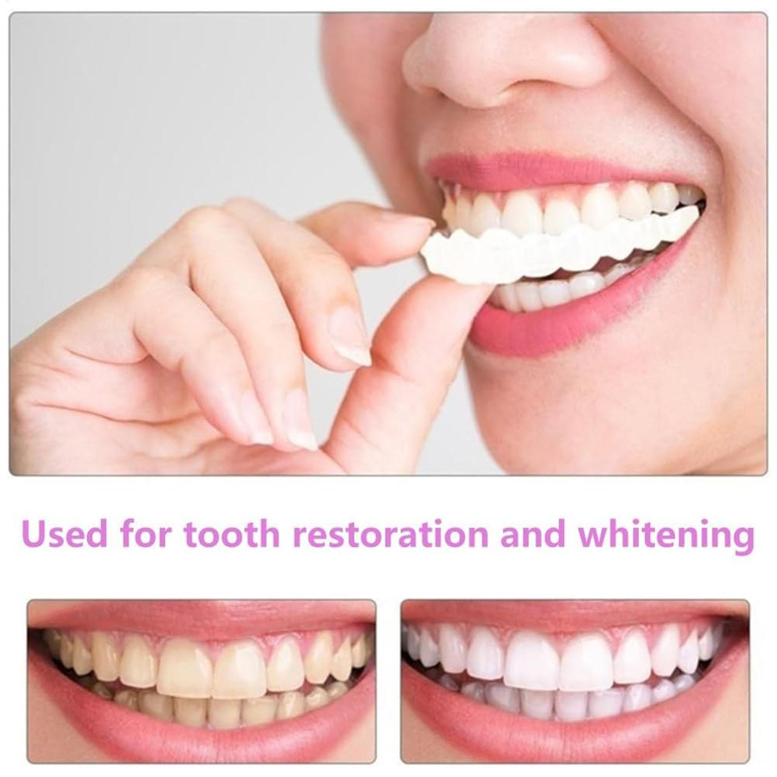 2 adet Erkek Kadın Geçici Diş  - Teeth Whitening Moulds incelemesi ve fiyatı