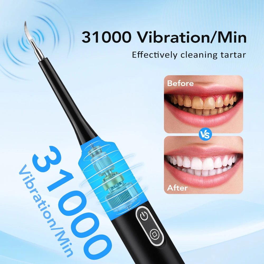 Elektrikli Sonik Titreşimli Di - Teeth Whitening Mouthwash incelemesi ve fiyatı