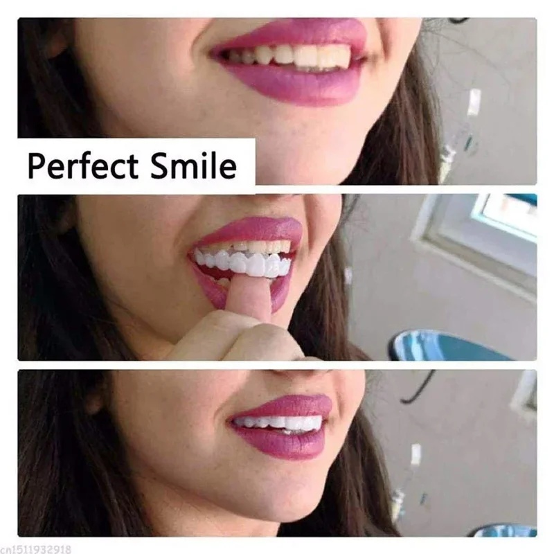 Çıkarılabilir Kaplama Diş Seti - Teeth Whitening Kit incelemesi ve fiyatı